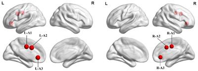 Altered anterior cingulate cortex subregional connectivity associated with cognitions for distinguishing the spectrum of pre-clinical Alzheimer’s disease